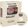 GallStone Export Guide