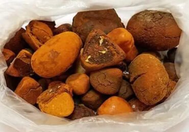 Gallstone Business in Nigeria: Opportunities, Sourcing & What You Must Know